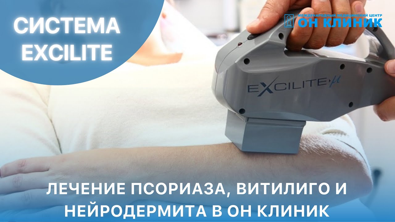 Нейродермит — причины, симптомы, диагностика, лечение и профилактика